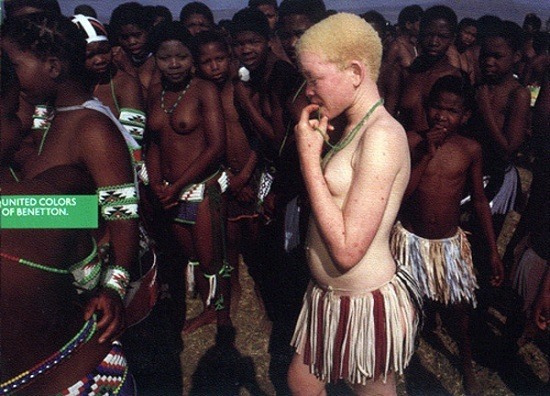 20 Изобюражение африканской женщины-альбиноса, на которую неодобрительно смотрят ее соплеменники